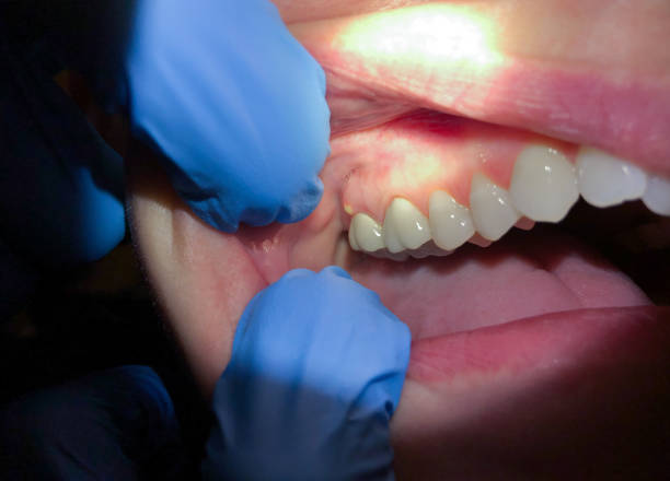 Best Pediatric Emergency Dentist in Macon, GA